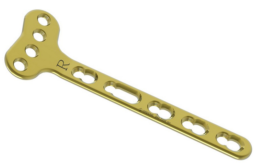 LCP VOLAR DISTAL RADIUS PLATE, EXTRA ARTICULAR